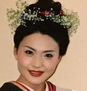 金子恵美が整形か画像比較｜注目は「目」「鼻」「顎」