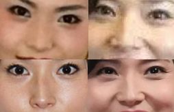 金子恵美の鼻
