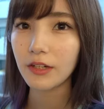 YouTuberかすが整形か画像比較|注目は「目」「鼻」 | 整形の館〜芸能人の現在と昔を画像で比較〜