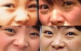 フワちゃんの鼻