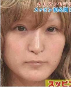 小原優花（ゆんころ）が整形か画像比較｜注目は「目」「鼻」「唇」「顎」
