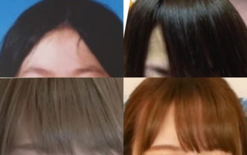 轟ちゃんのおでこ