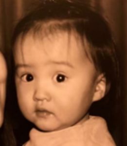 Kōki,（木村光希）が整形か画像比較｜注目は「目」「鼻」