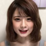 YouTuberにたまごが整形か画像比較｜注目は「目」「顎」