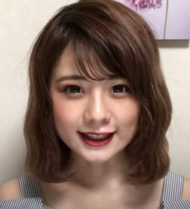 YouTuberにたまごが整形か画像比較｜注目は「目」「顎」