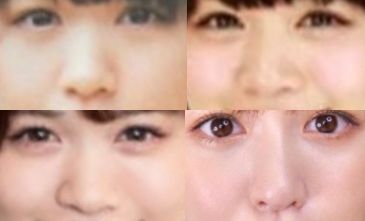 ゆうこすの鼻