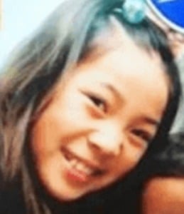 フワちゃん（不破遥香）が整形か画像比較｜注目は「目」「鼻」「唇」「顎」