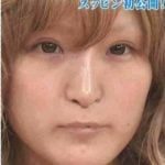 小原優花（ゆんころ）が整形か画像比較｜注目は「目」「鼻」「唇」「顎」