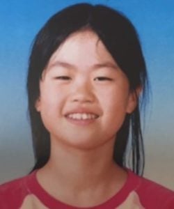 整形アイドル轟ちゃんの整形前を画像比較｜注目は「おでこ」「目」「鼻」「唇」「顎」「エラ」
