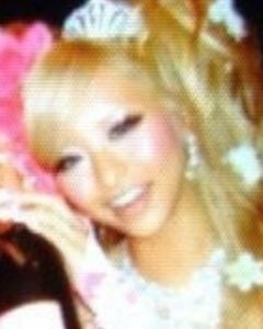 門りょうが整形か画像比較｜注目は「目」「鼻」「唇」「フェイスライン」