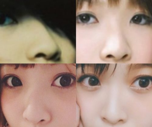 Maynの鼻