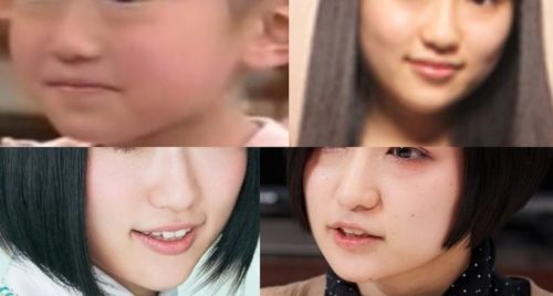 悠木碧のフェイスライン