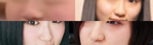 悠木碧の鼻