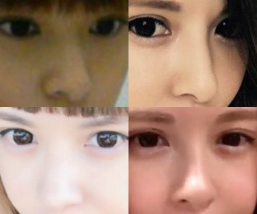 森藤恵美の鼻