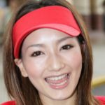 辻元舞が整形か画像比較｜注目は「目」「鼻」「唇」