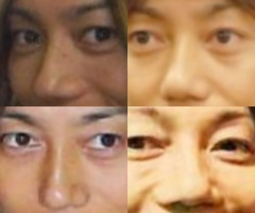青山光司の鼻