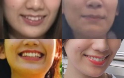 佐藤美希の口