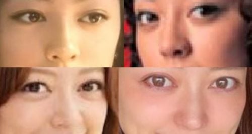 松本莉緒の鼻