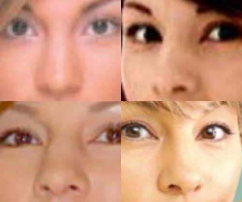 梅宮アンナの鼻