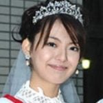 三浦奈保子が整形か画像比較｜注目は「目」「鼻」
