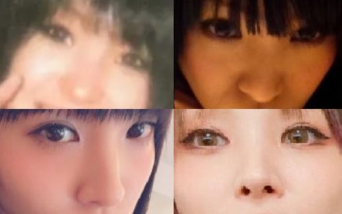 LiSA（織部里沙）の鼻