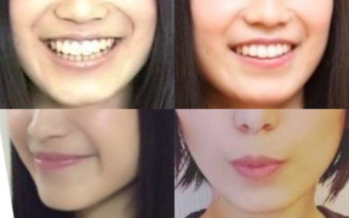 miwaの口