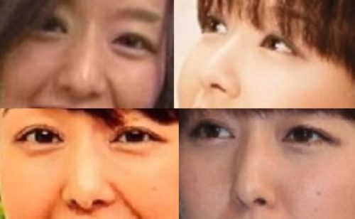 中村仁美の鼻