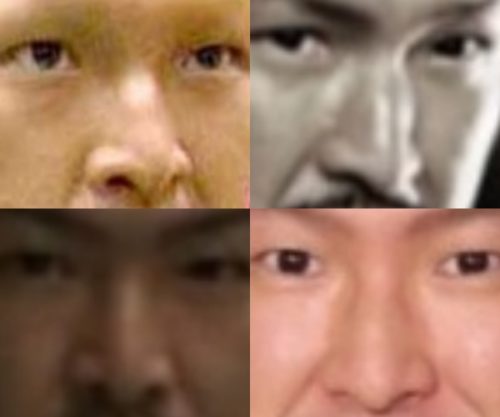 中村獅童の鼻