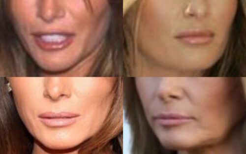 メラニア・トランプの口