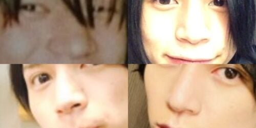 北村諒の鼻