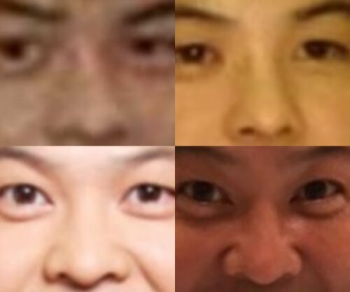 月亭方正（山崎邦正）の鼻