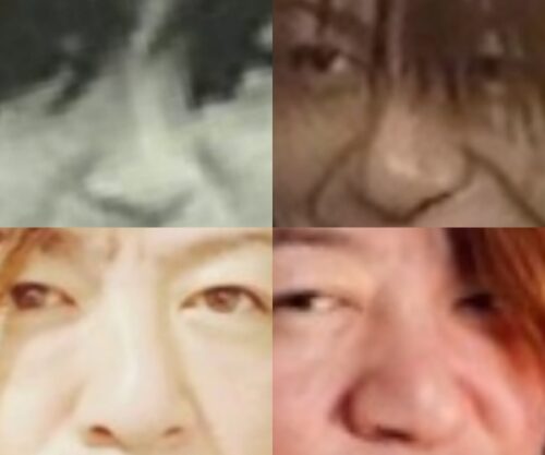 TERU（GLAY）の鼻