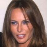 メラニア・トランプが整形か画像比較｜注目は「目」「鼻」「唇」「顎」「フェイスライン」