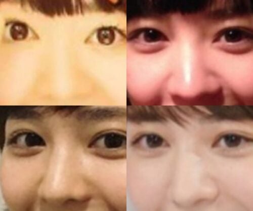 吉谷彩子の鼻