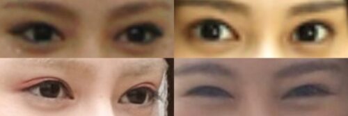山本千尋の目