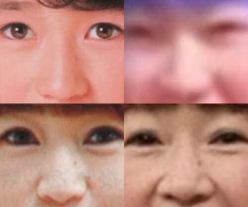 山瀬まみの鼻