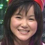 光井愛佳が整形か画像比較｜注目は「目」「鼻」「顎」