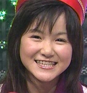 光井愛佳が整形か画像比較｜注目は「目」「鼻」「顎」