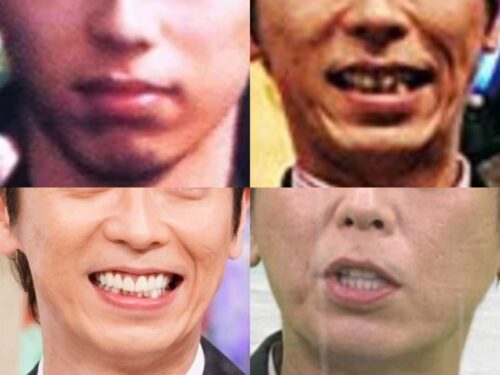 後藤輝基の口