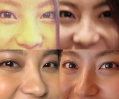 Rihwaの鼻