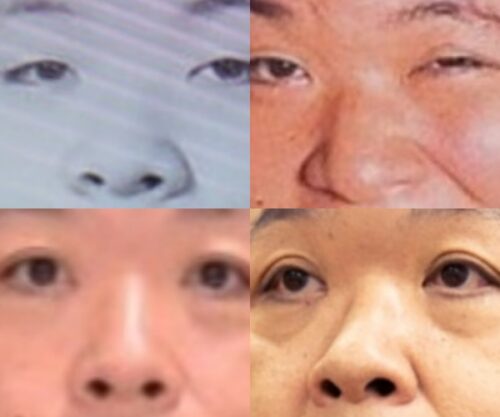 伊集院光の鼻