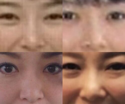 中澤有美子の鼻
