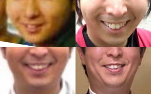 有村昆の口