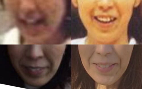 大林素子の口