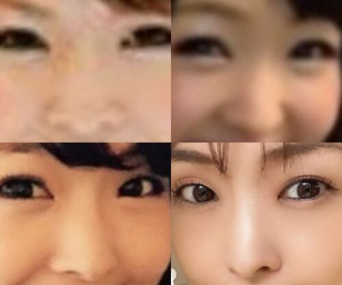 大西暁子の鼻