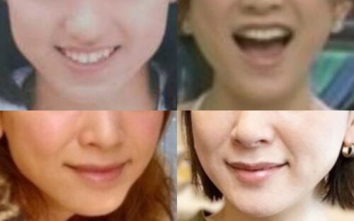 山口美沙の口