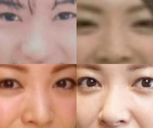 山口美沙の鼻