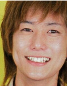 平岡祐太が整形か画像比較｜注目は「目」「鼻」「唇」「顎」「フェイスライン」