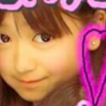 みちょぱ（池田美優）が整形か画像比較｜注目は「目」「顎」
