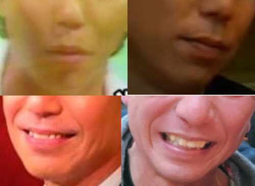 吉村明宏の口